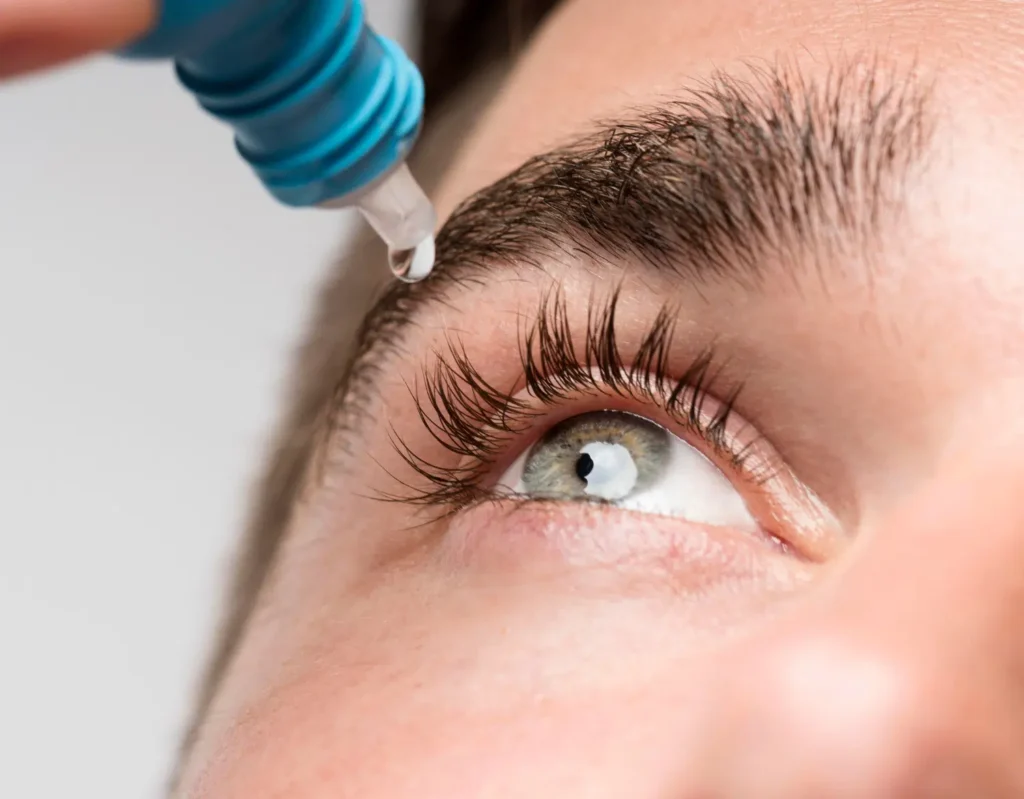 Woman getting eye drops after LASIK surgery.