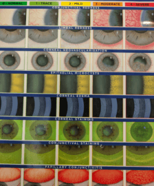 Contact Lens Complication Chart